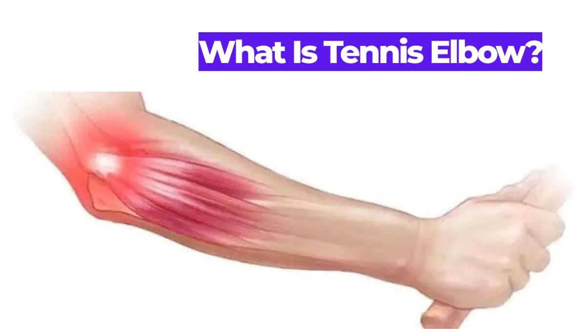 What Is Tennis Elbow? Causes, Symptoms, and Treatment